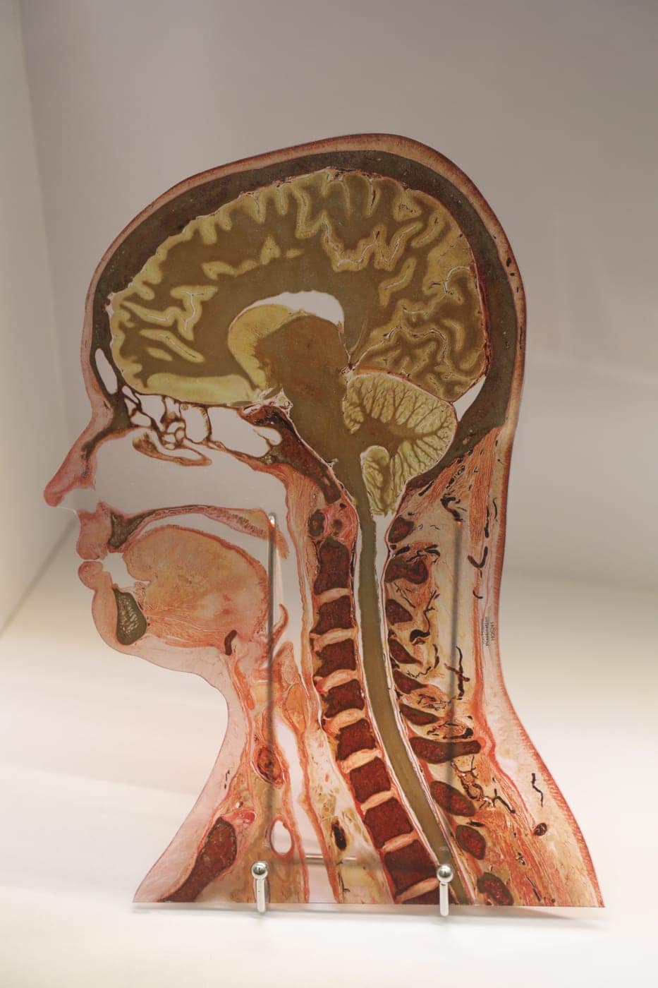 A sagittal slice of a human brain