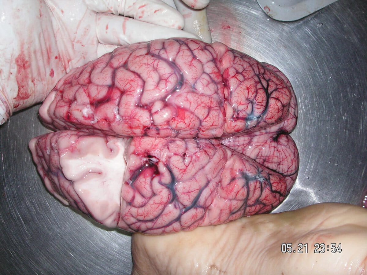 human brain, the brain
