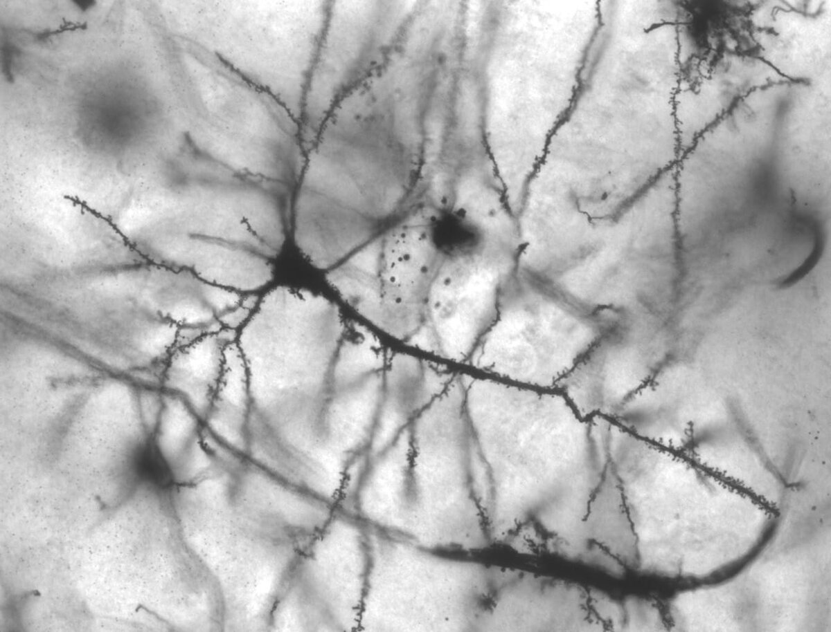 A pyramidal neuron of the hippocampus