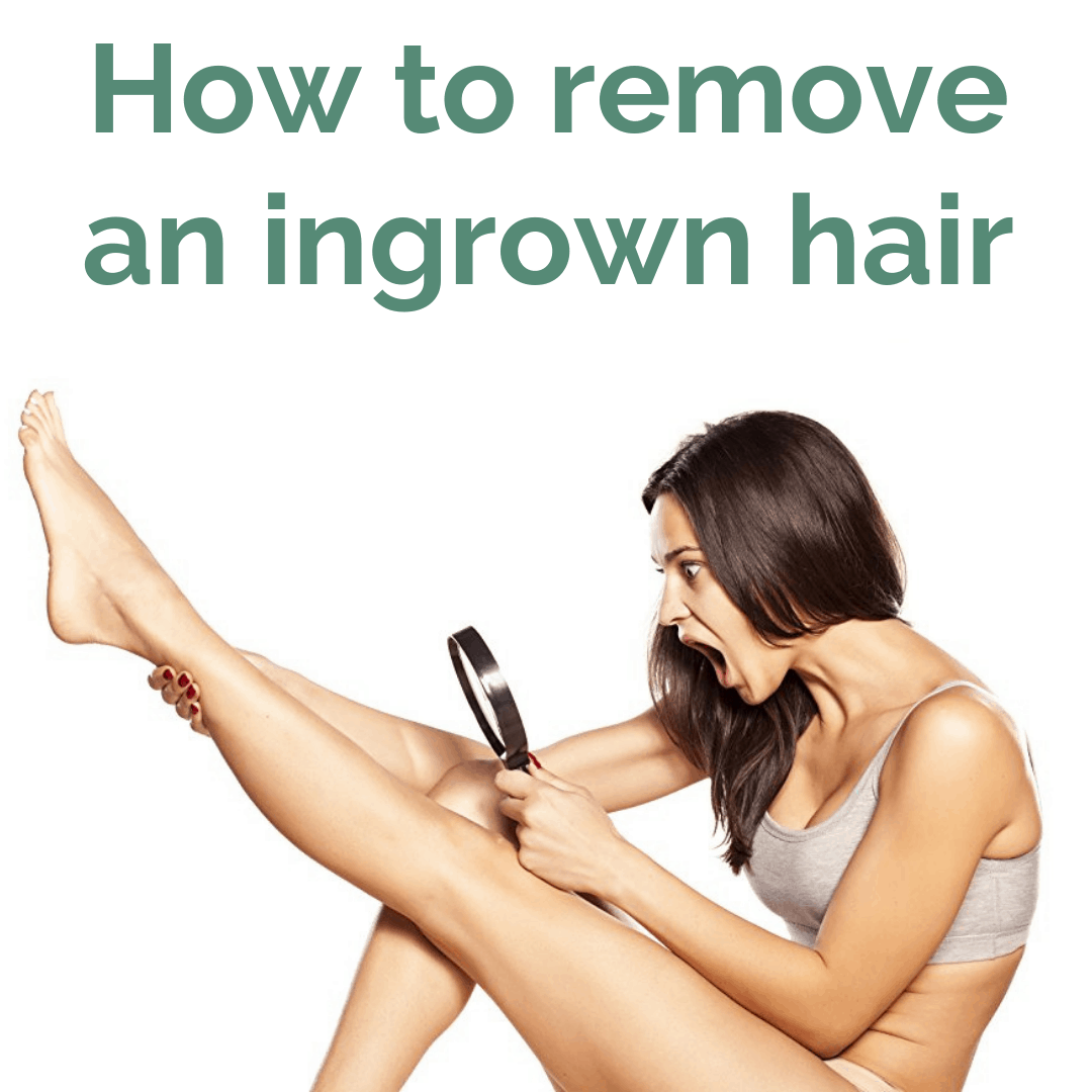 How To Remove An Ingrown Hair Ingrown Hair Solutions February 2020