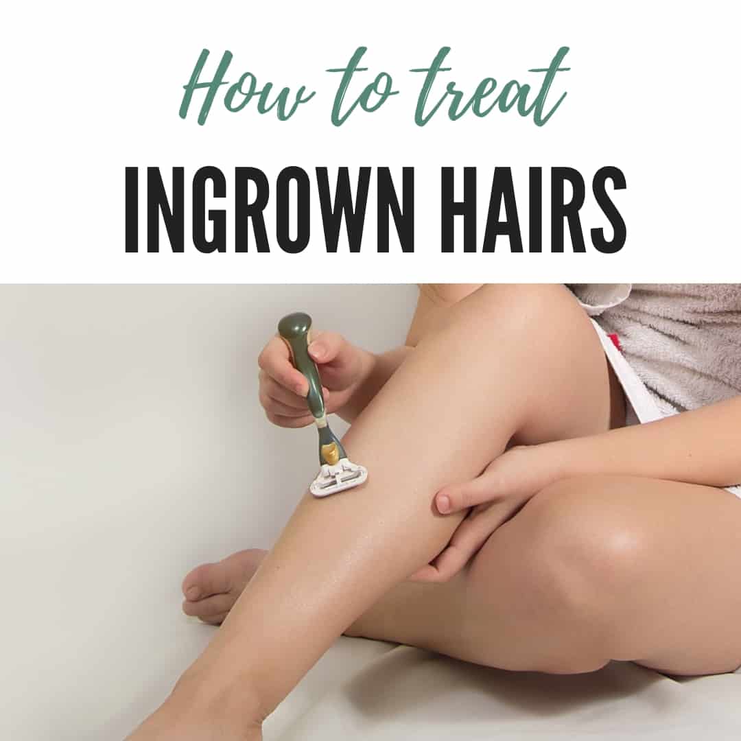 How Can I Treat Ingrown Hairs Razor Burn And Bikini Bumps