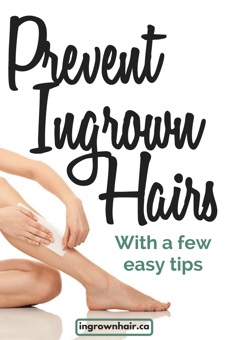 Prevent Ingrown Hairs With A Few Easy Tips Ingrownhair Ca