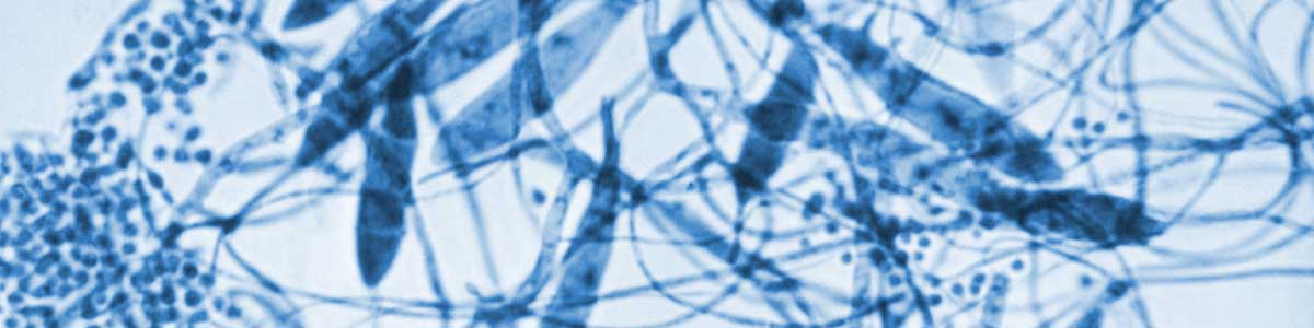 Under a magnification of 475X, this photomicrograph revealed some of the ultrastructural morphology exhibited by the dermatophytic fungal organism, Trichophyton mentagrophytes, including strands of filamentous hyphae, numbers of cigar-shaped, septate macroconidia, and numerous, spheroid-shaped microconidia. Read more at Aerovex Systems (aerovexsystems.com)
