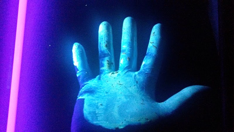 Glowing hand exposed to coal tar sealers