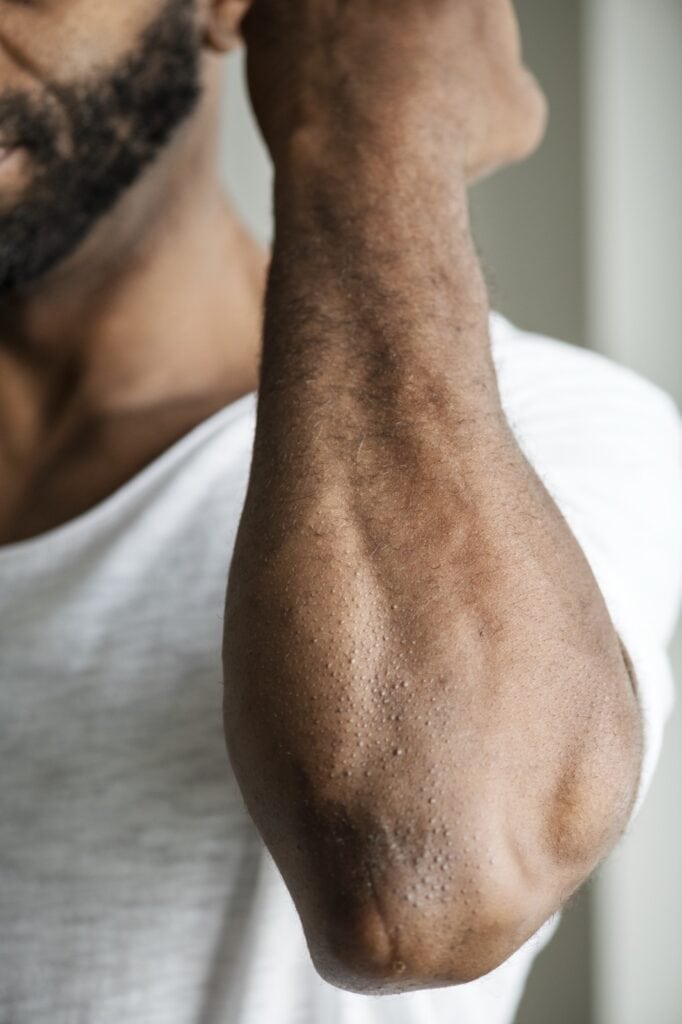 Close-up of a man's forearm and elbow, with fine arm hair
