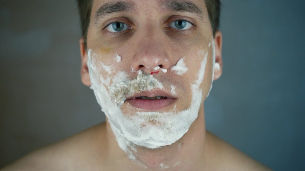 Man with patchy shaving cream on his face and reddened skin around his chin and upper lip