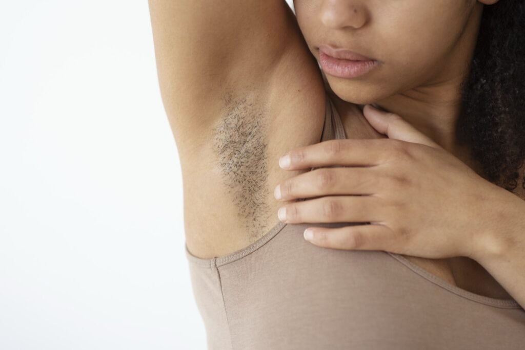Woman raising her arm to show her underarm hair