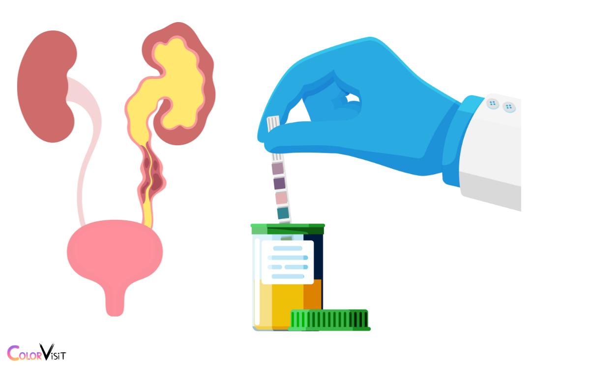 Factors Influencing Urine Color Change