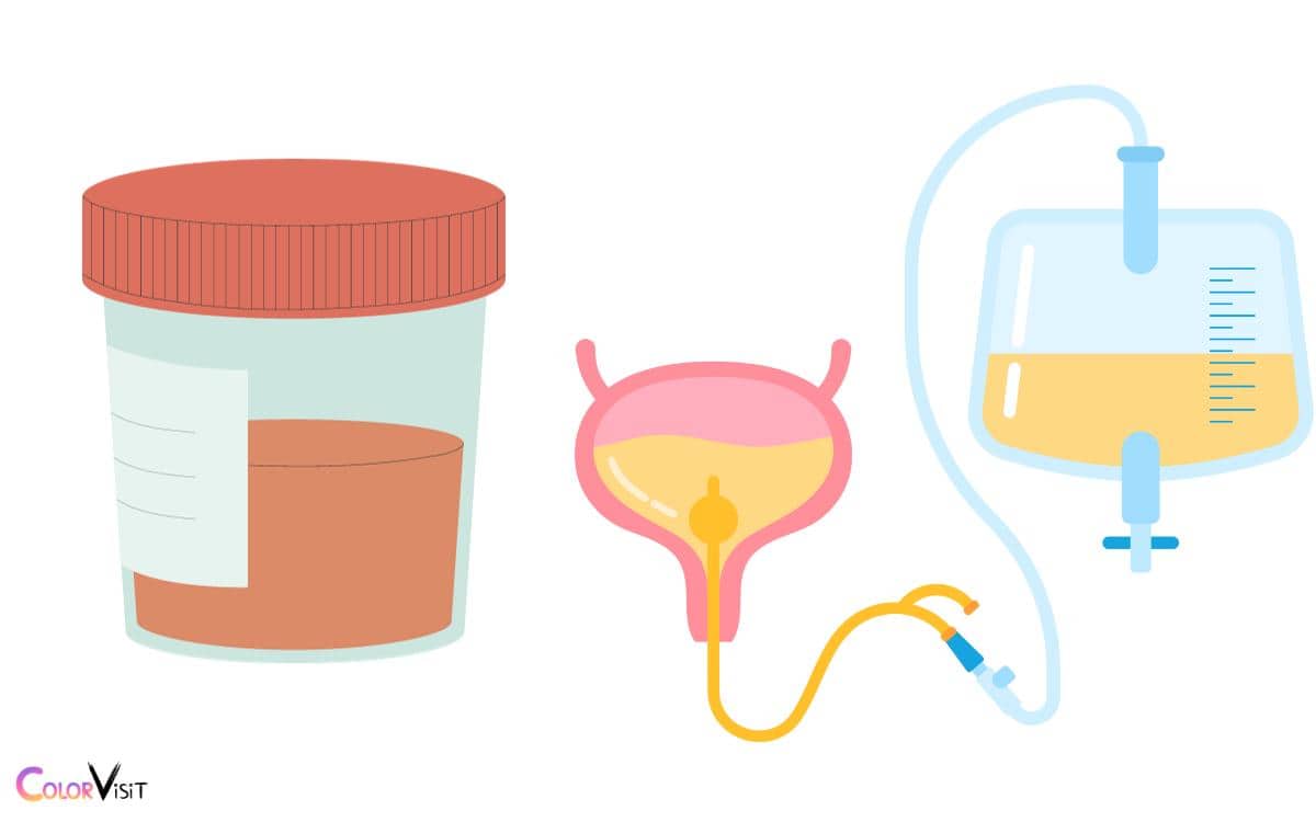 When to Seek Medical Attention for Urine Color