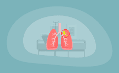 9 Best Charities for Lung Cancer Research (Complete 2025 List)