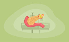 9 Best Charities That Fight Pancreatic Cancer (Complete 2025 List)