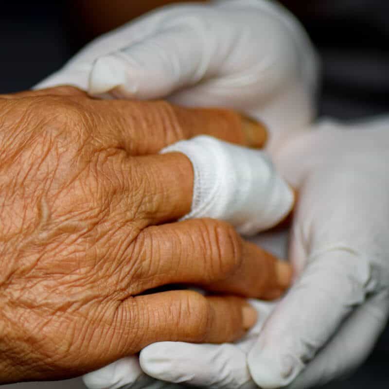 wound care service img
