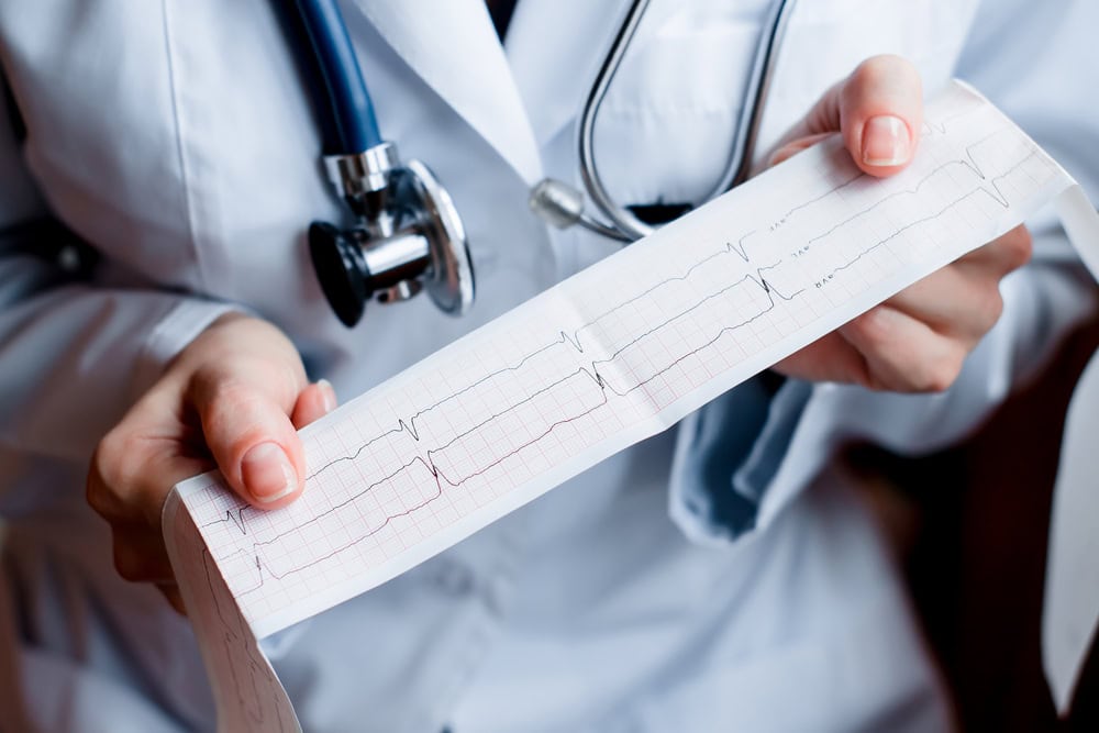 Lernen Sie die Vorteile von 3-Kanal-EKG-Geräten kennen Bild: EKG Geräte im Überblick