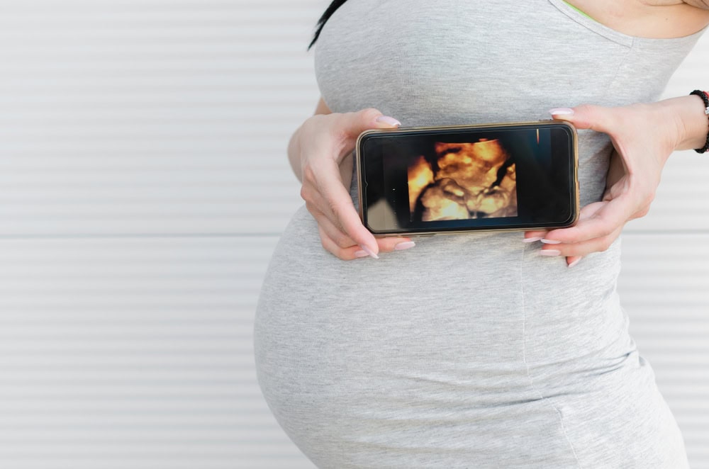 Erfahren Sie mehr über Ultraschall für Handys Bild: Eine Frau hält ein Handy mit einem Ultraschall-Bild vor ihren schwangeren Bauch