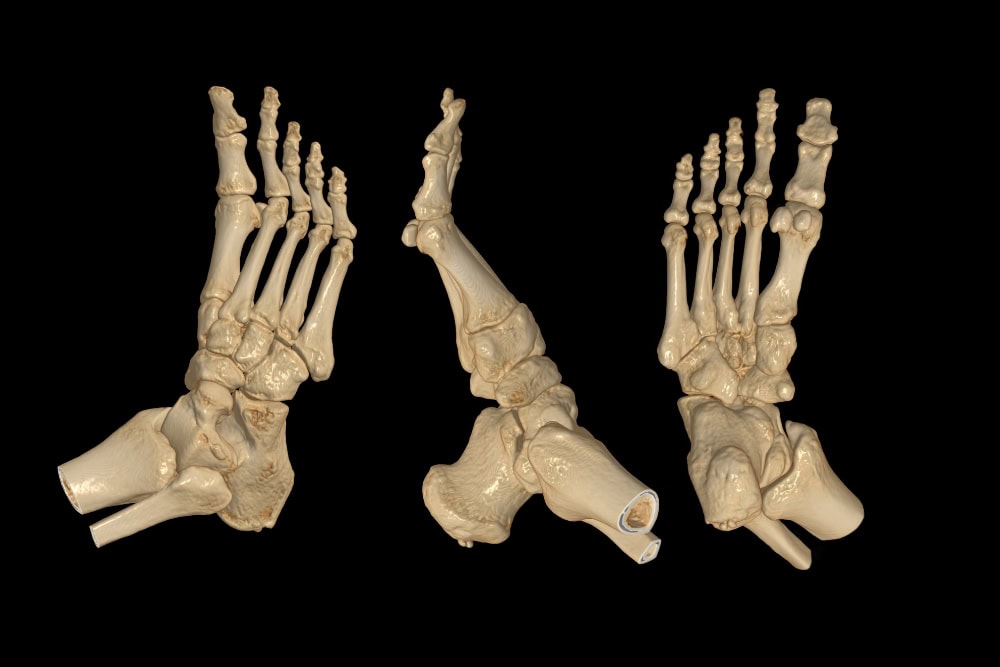 Ein 3D-Modell von einem Fuß, welches mit einem orthopädischen DVT-Gerät generiert worden ist.