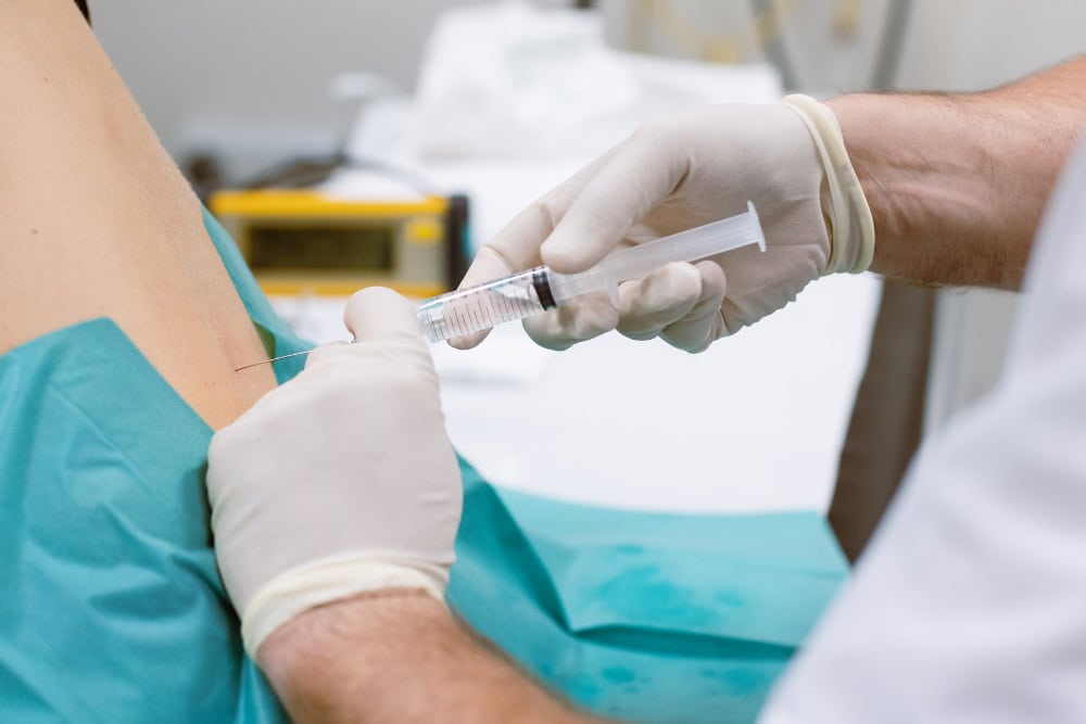 Ein Arzt spritzt einem Patient Kortison im Rahmen einer Infiltrationstherapie.