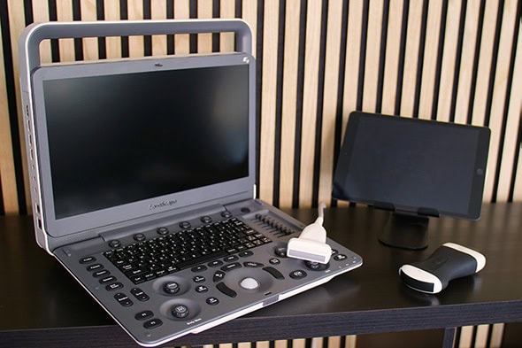 Mobiles Ultraschallgerät mit Monitor und Tastatur neben einem Schallkopf, einem Handheld-Ultraschallgerät und einem Tablet vor einer Holzwand.