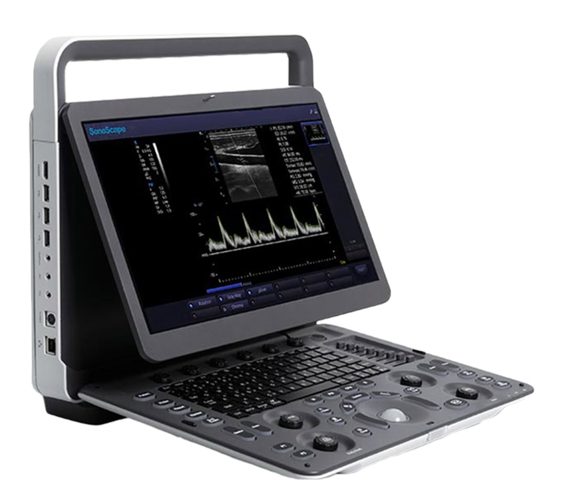 Sonoscape E2 Ultraschallgerät