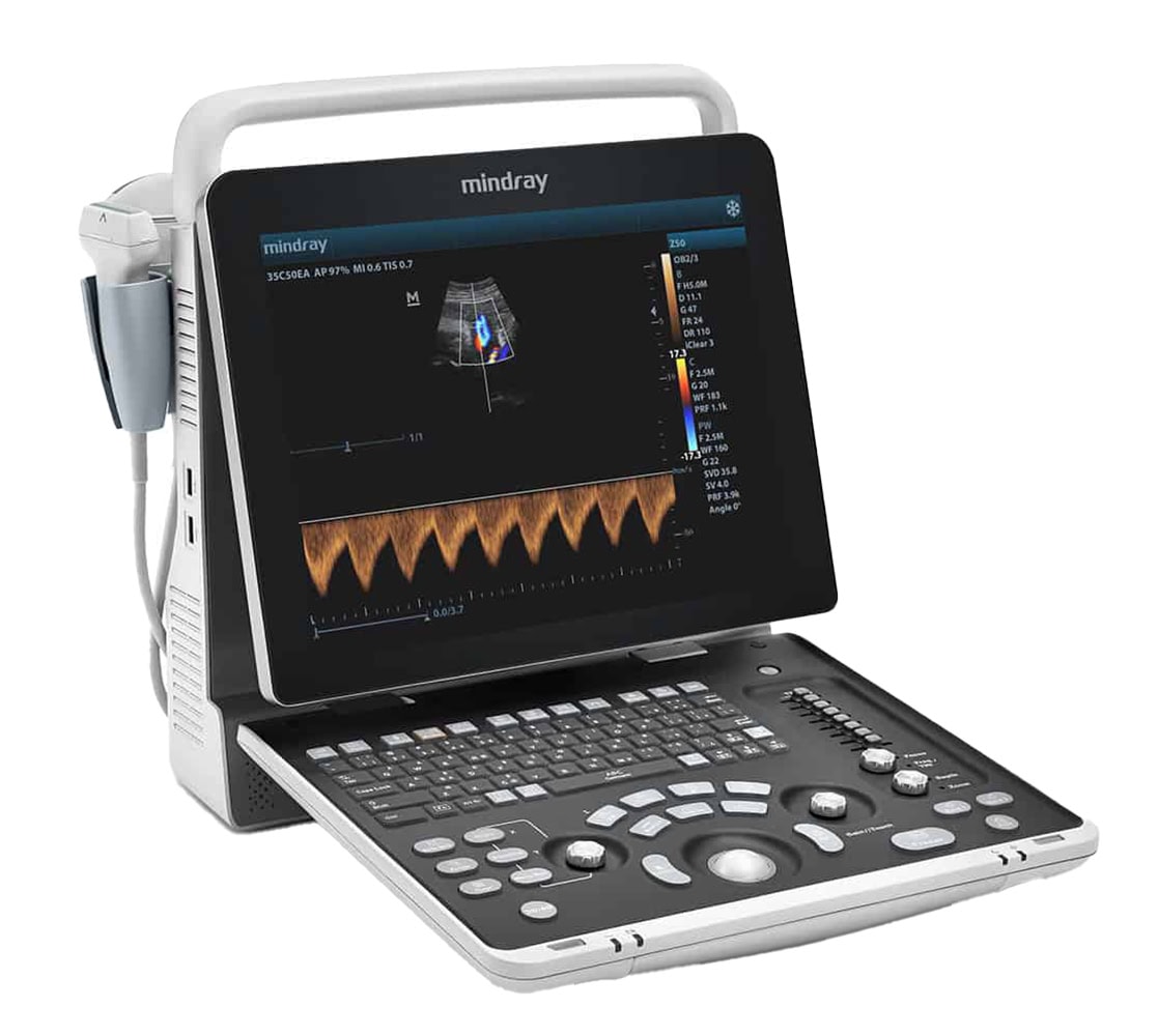 Mindray Z50 Ultraschallgerät