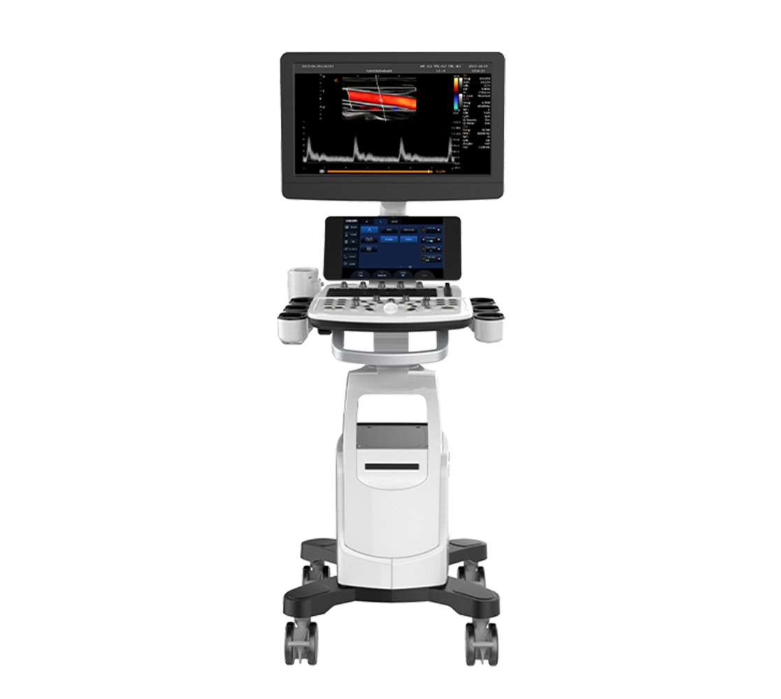 Chison CBit 6 Ultraschallgerät