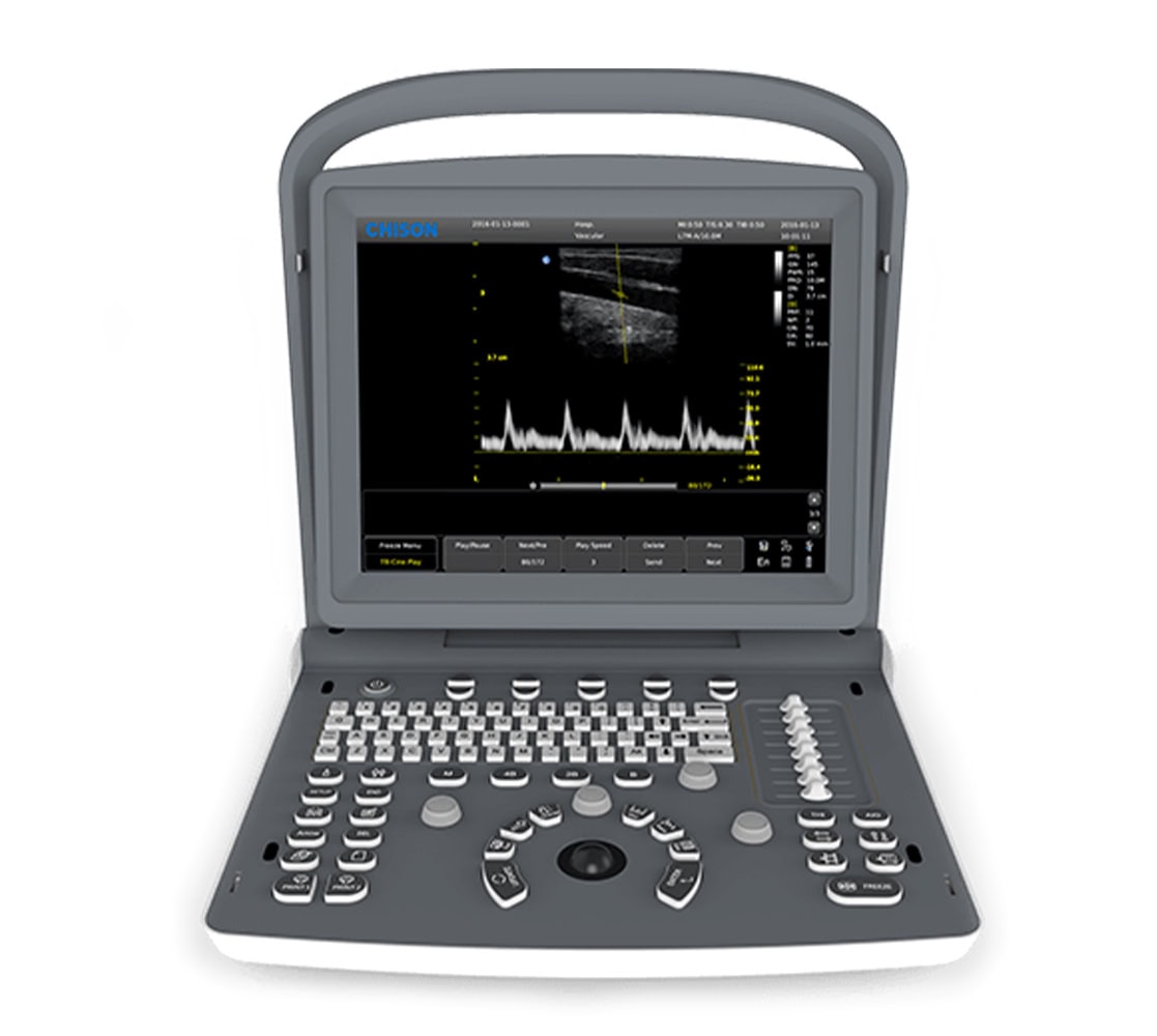 Chison Eco 2 Ultraschallgerät