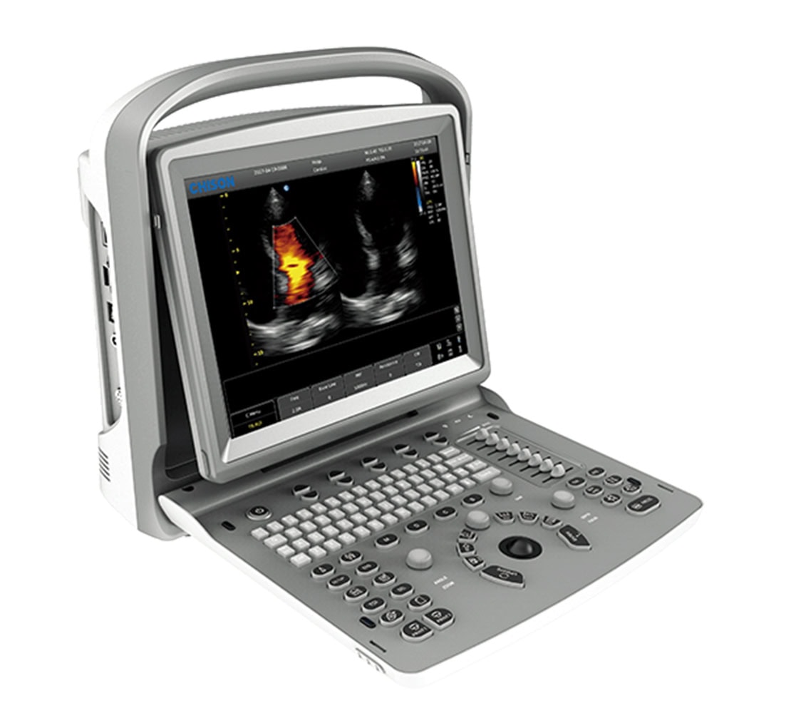 Chison Eco 6 Ultraschallgerät