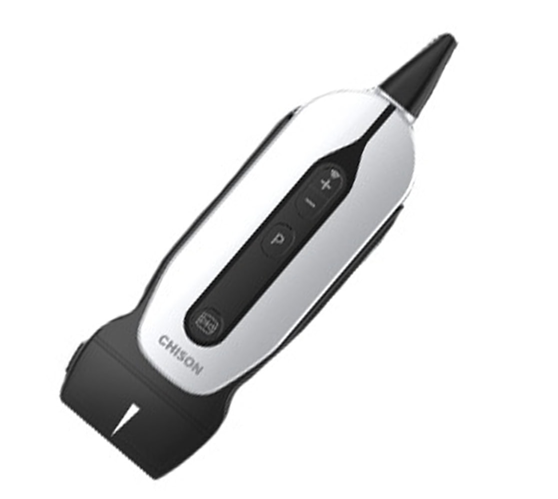 Chison SonoEye Ultraschallgerät