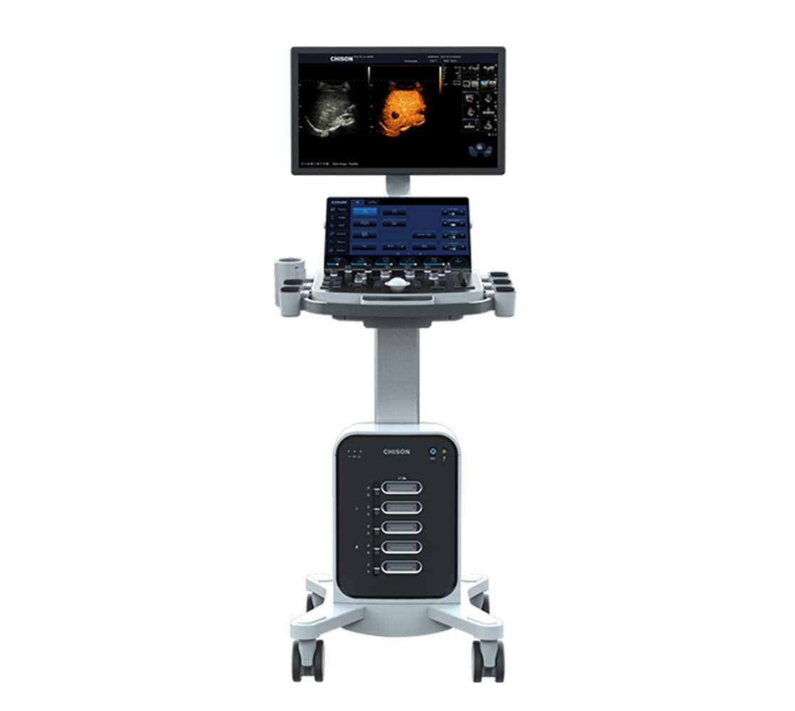 Chison SonoMax 7 Ultraschallgerät