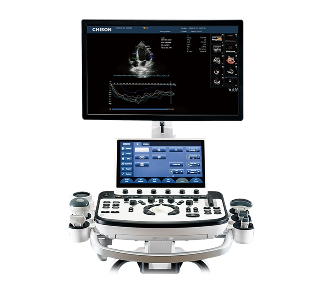 Chison XBit 90 Ultraschallgerät