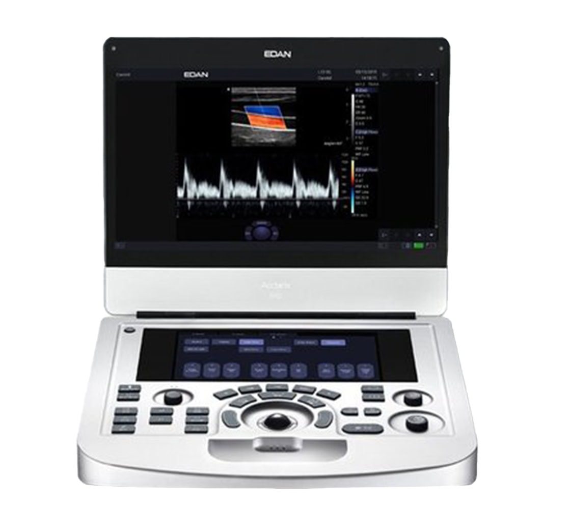 Edan Acclarix AX2 Ultraschallgerät