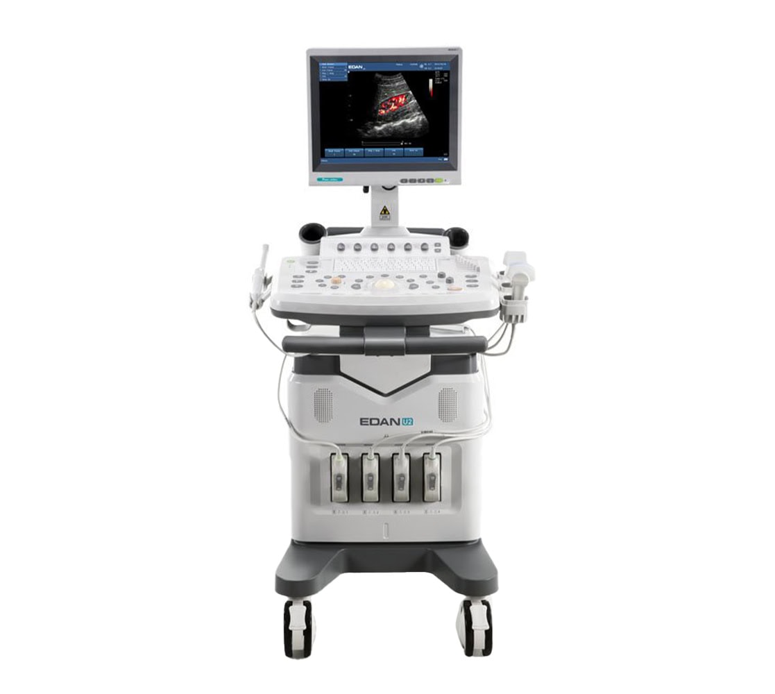 Edan U2 Prime Edition Ultraschallgerät