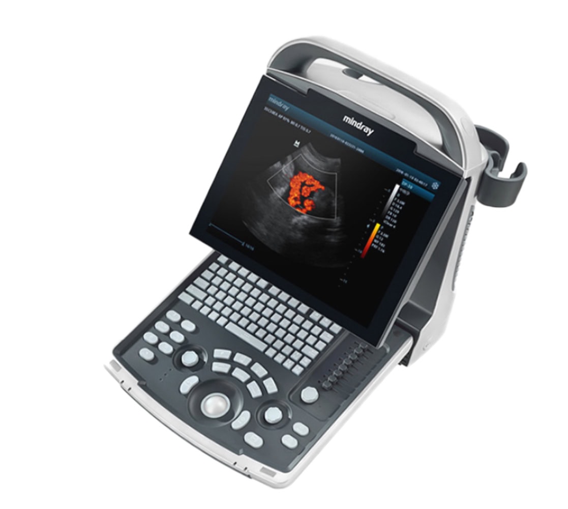 Mindray DP-30 Ultraschallgerät