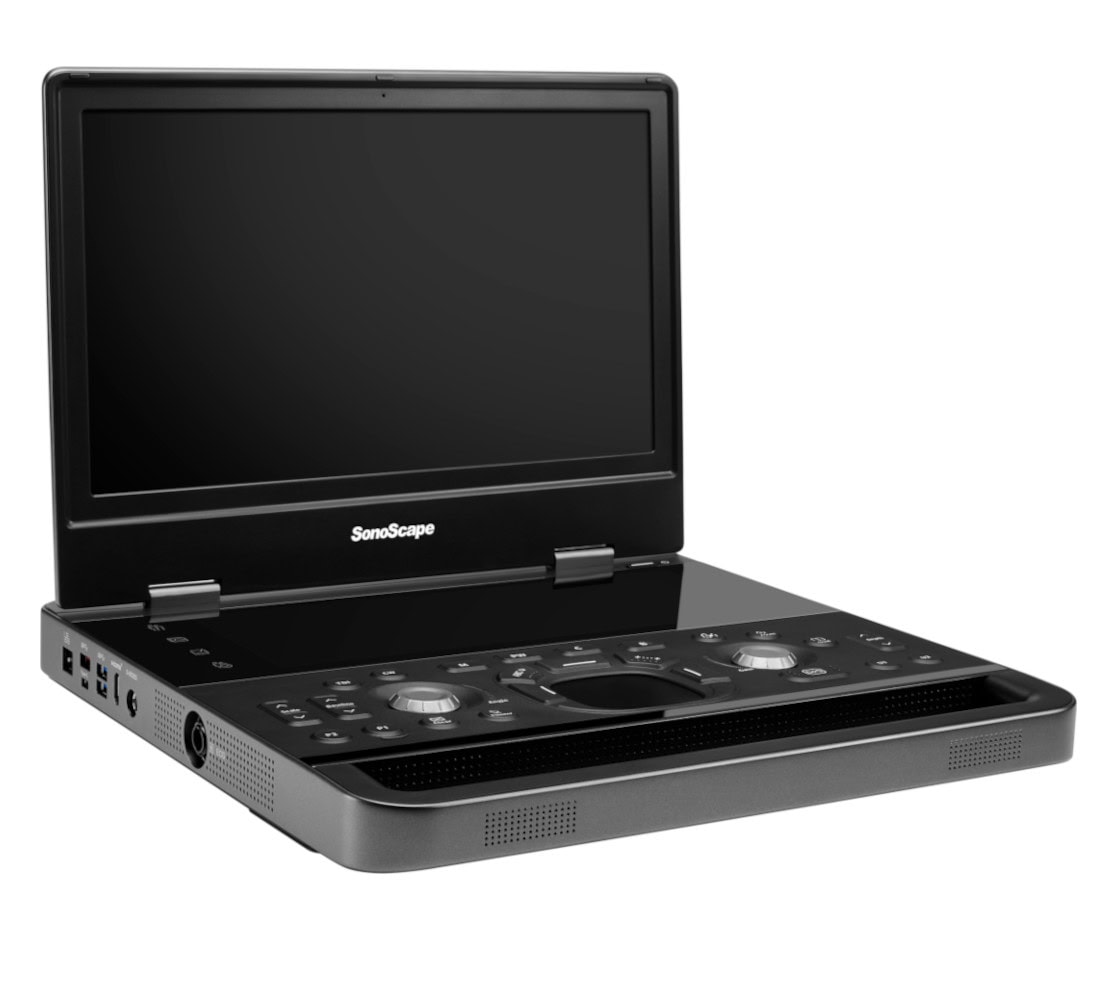 SonoScape E11