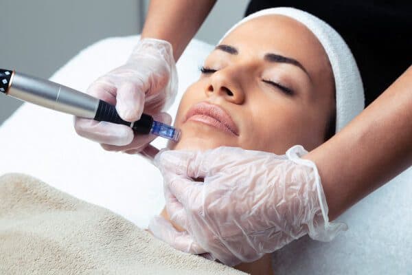 microneedling get started image