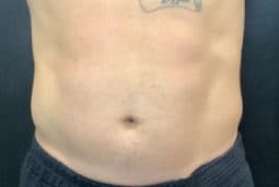 man before