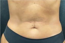 women before