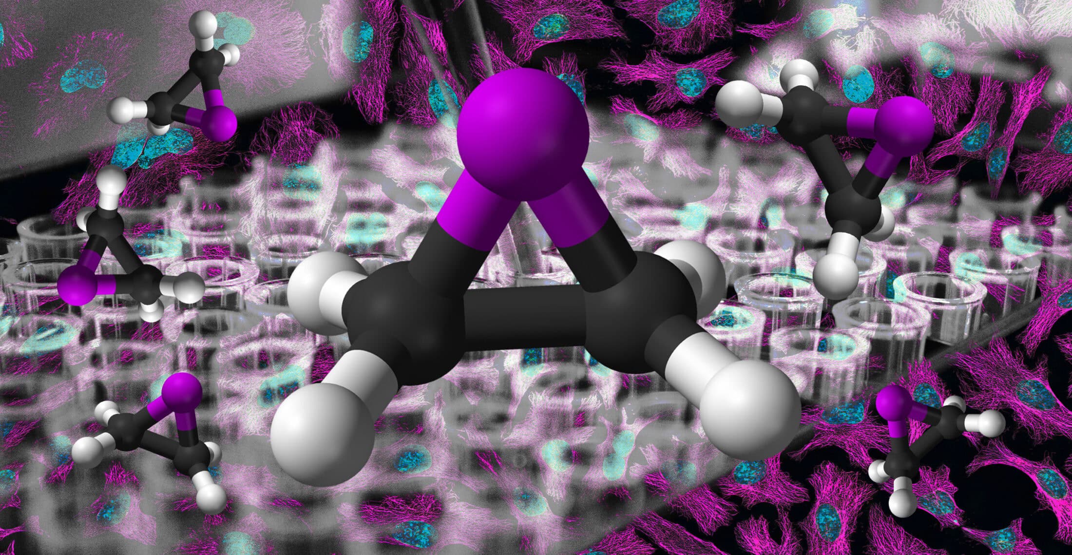 NAT-ethylene-oxide-Parkinson