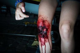 Close up flash street photograph of the bleeding knee of a child in Brussels