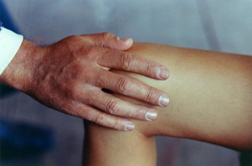 Claire’s Knee_3