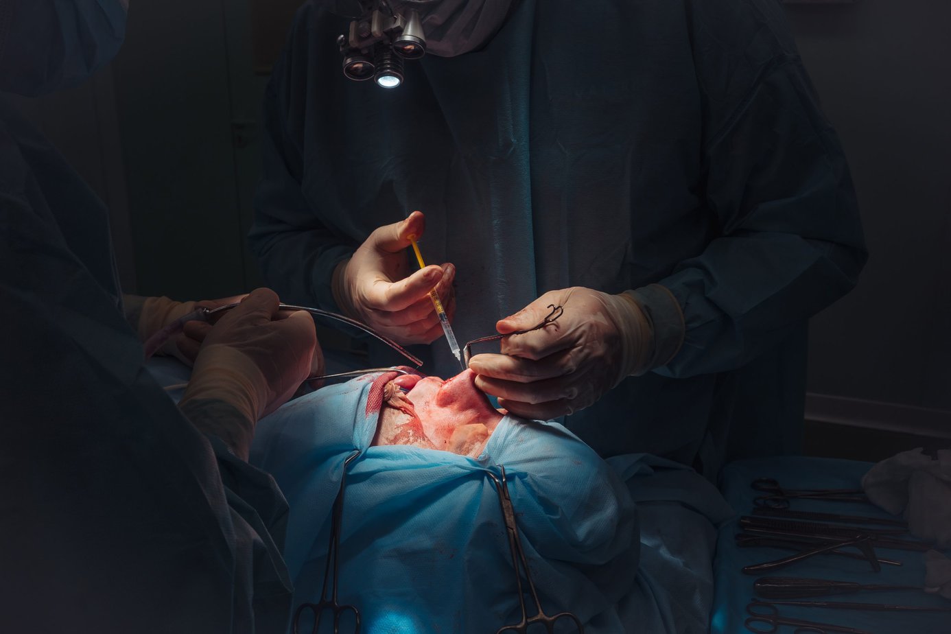 Rhinoplastie médical Prix