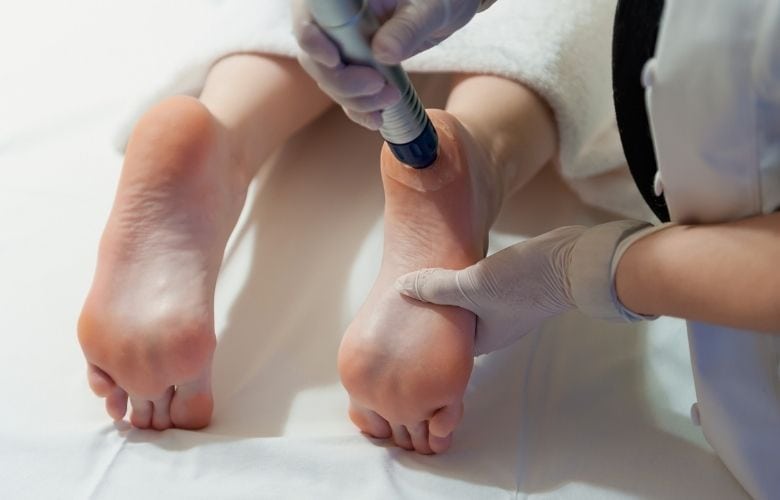 Anwendung eines radialen Stoßwellengeräts an der Ferse eines Patienten während einer physiotherapeutischen Behandlung.