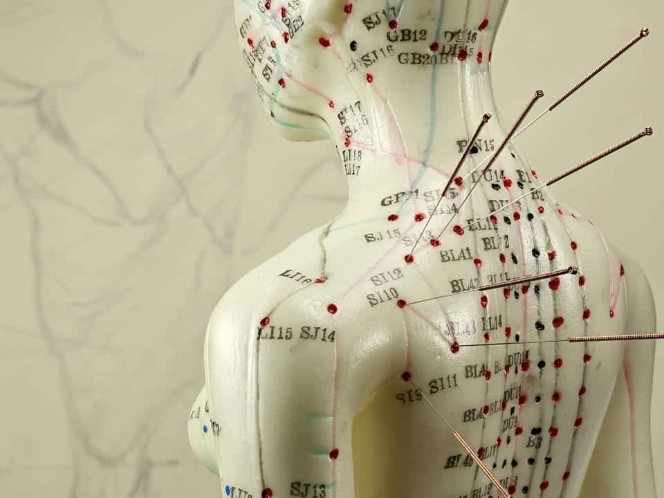Acupuncturist Near Me