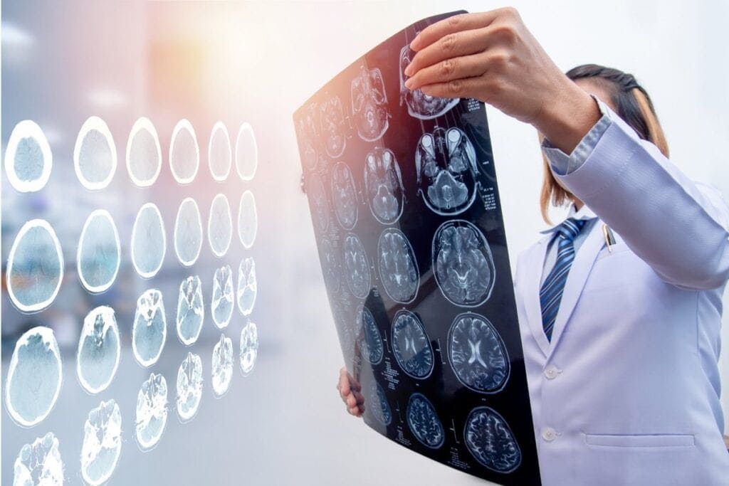 TBI Treatment