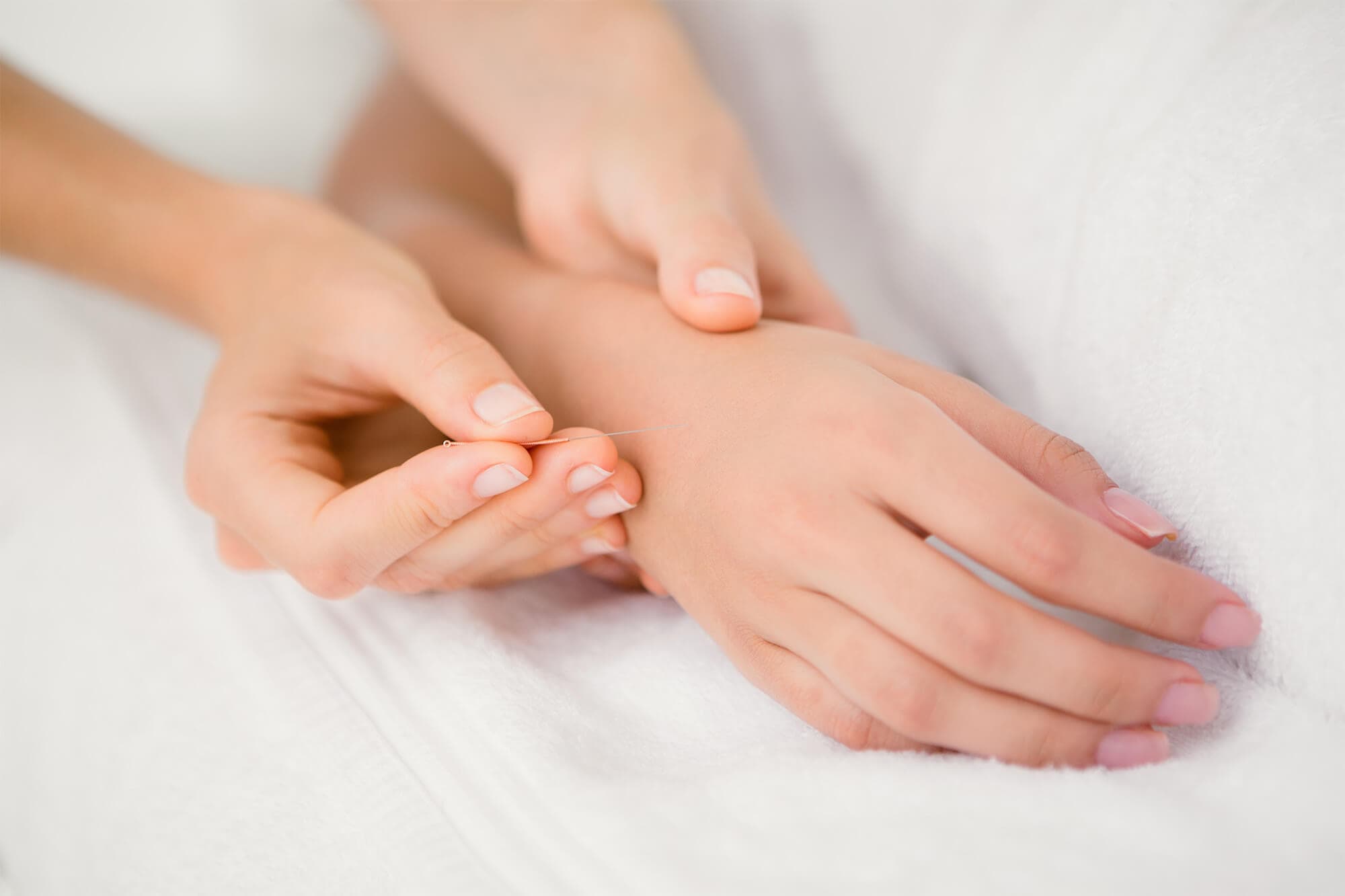 Acupuncture for fertility