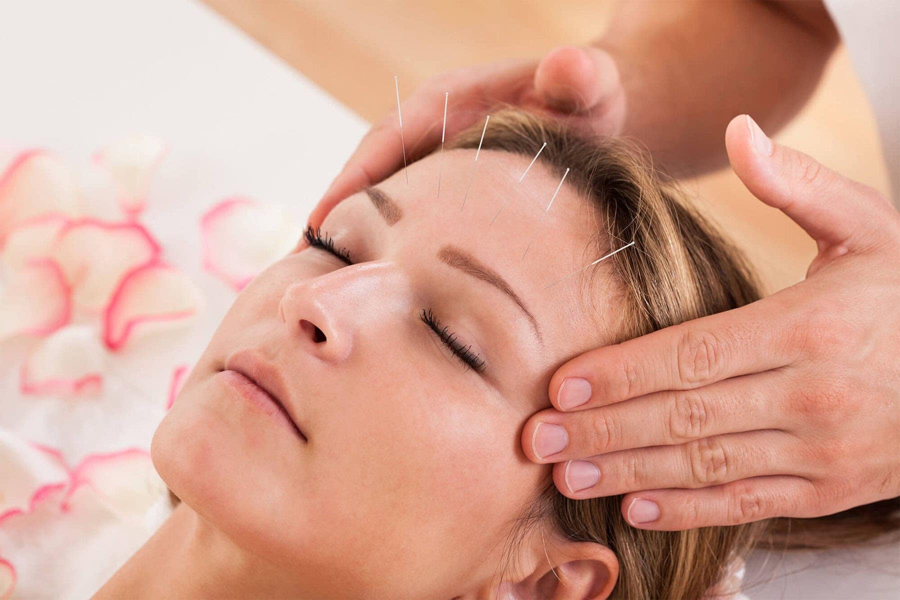 Acupuncture For Insomnia