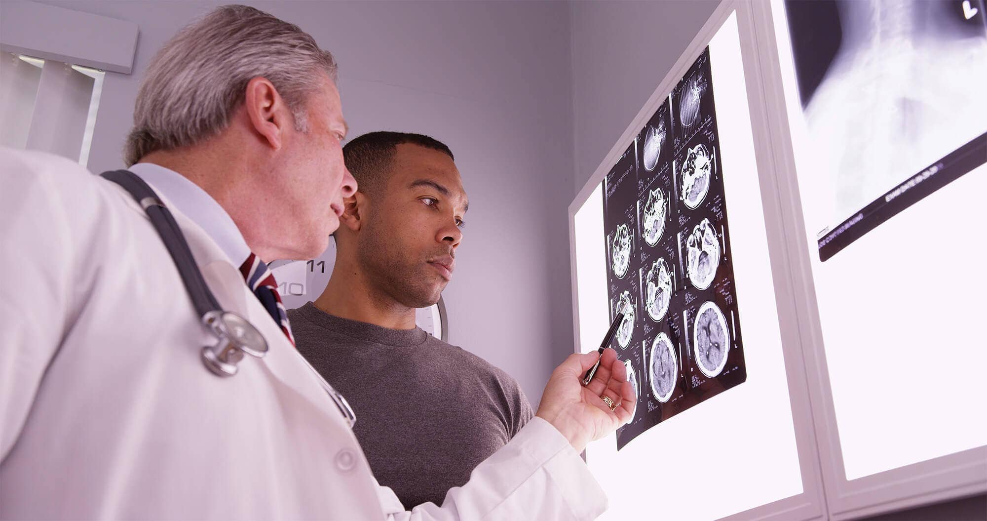 Brain injury