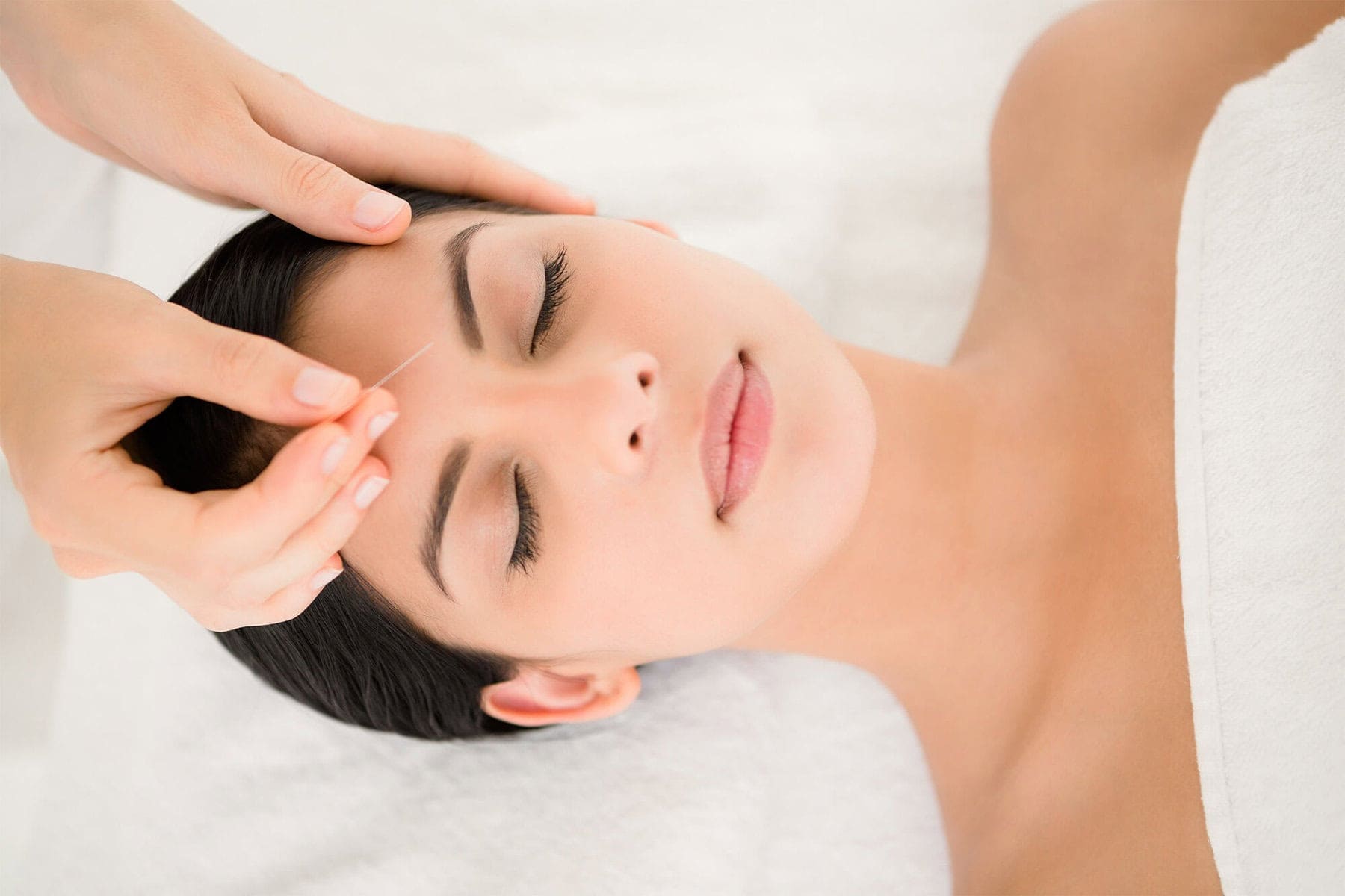 Cosmetic Acupuncture