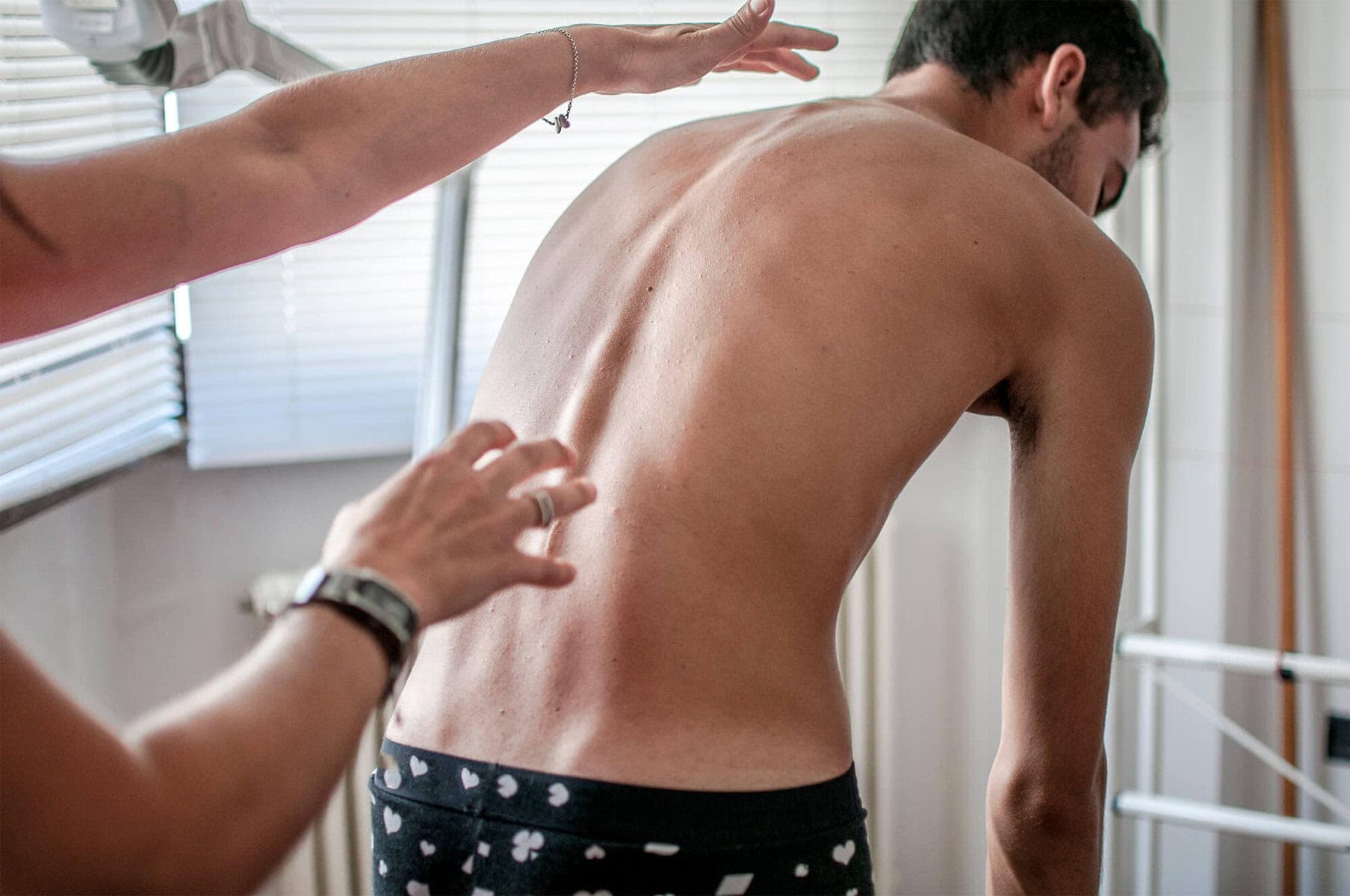 Scoliosis treatment in Burlington, Ontario