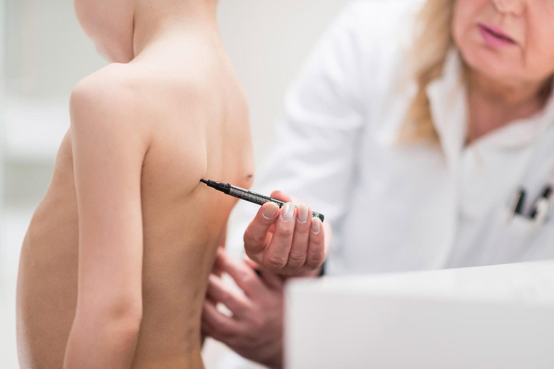 Signs and symptom of scoliosis