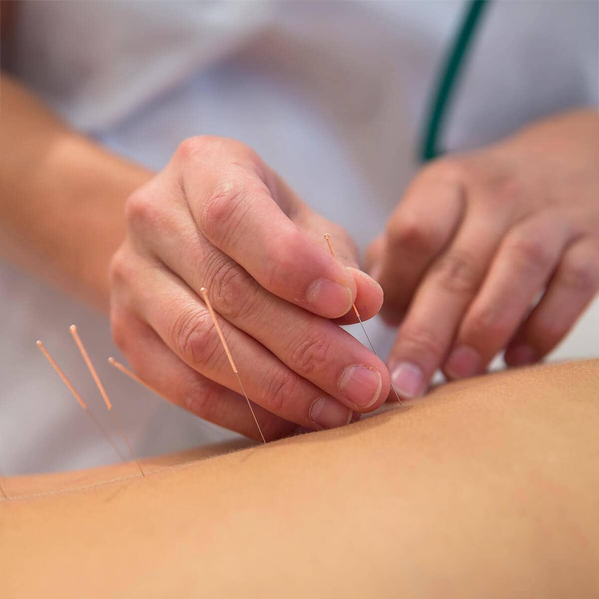 "Laser acupuncture treatment"